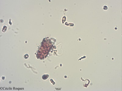 protozoo/Tintinnopsis rapa,parva,nana (1)(copy)_thumb.jpg